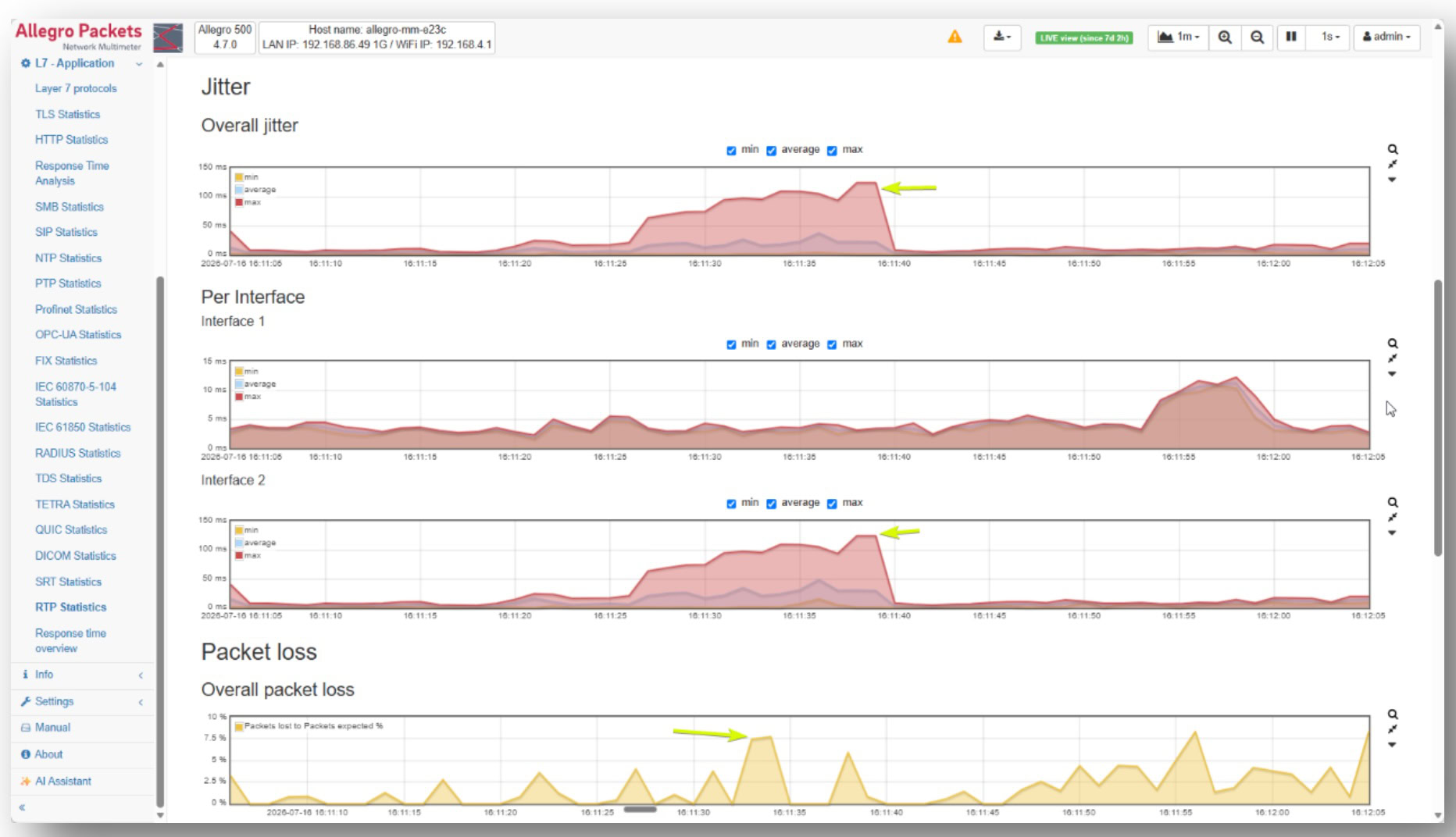 Allegro Packets RTP quality trends showing jitter measurements and packet loss over time for real-time communications traffic